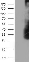 LDLRAP1 Antibody in Western Blot (WB)