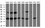 LDLRAP1 Antibody in Western Blot (WB)