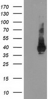 LDLRAP1 Antibody in Western Blot (WB)