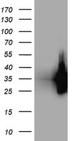 LDLRAP1 Antibody in Western Blot (WB)