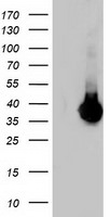 LDLRAP1 Antibody in Western Blot (WB)