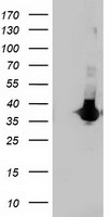 LDLRAP1 Antibody in Western Blot (WB)