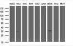 LDLRAP1 Antibody in Western Blot (WB)