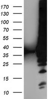 LDLRAP1 Antibody in Western Blot (WB)