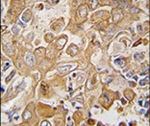 LECT1 Antibody in Immunohistochemistry (IHC)