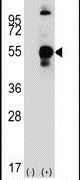 LECT1 Antibody in Western Blot (WB)