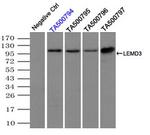 LEMD3 Antibody in Immunoprecipitation (IP)