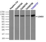 LEMD3 Antibody in Immunoprecipitation (IP)