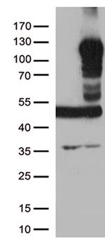 LEMD3 Antibody in Western Blot (WB)