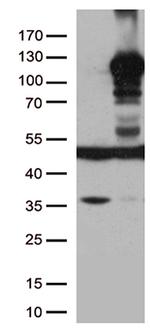 LEMD3 Antibody in Western Blot (WB)