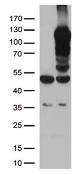 LEMD3 Antibody in Western Blot (WB)