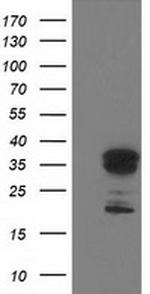 LENG1 Antibody in Western Blot (WB)