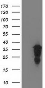 LENG1 Antibody in Western Blot (WB)