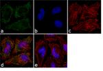 Catalase Antibody in Immunocytochemistry (ICC/IF)