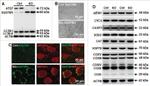 Catalase Antibody in Western Blot (WB)