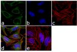 Catalase Antibody in Immunocytochemistry (ICC/IF)