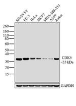CDK5 Antibody in Western Blot (WB)