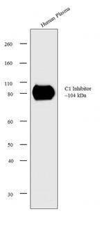C1 inhibitor Antibody in Western Blot (WB)
