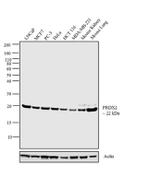 PRDX2 Antibody in Western Blot (WB)