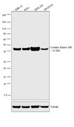 Creatine Kinase MB Antibody in Western Blot (WB)