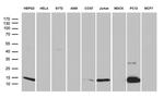 LGALS1 Antibody in Western Blot (WB)