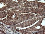 LGALS3 Antibody in Immunohistochemistry (Paraffin) (IHC (P))