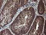LGALS3 Antibody in Immunohistochemistry (Paraffin) (IHC (P))