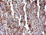 LGALS3 Antibody in Immunohistochemistry (Paraffin) (IHC (P))