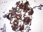 LGALS3 Antibody in Immunohistochemistry (Paraffin) (IHC (P))