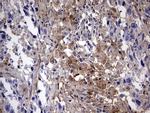 LGALS3 Antibody in Immunohistochemistry (Paraffin) (IHC (P))