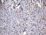 LGALS3 Antibody in Immunohistochemistry (Paraffin) (IHC (P))