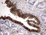 LGALS3 Antibody in Immunohistochemistry (Paraffin) (IHC (P))