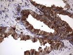 LGALS3 Antibody in Immunohistochemistry (Paraffin) (IHC (P))