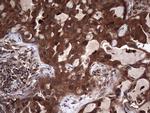 LGALS3 Antibody in Immunohistochemistry (Paraffin) (IHC (P))