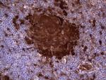 LGALS3 Antibody in Immunohistochemistry (Paraffin) (IHC (P))