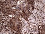 LGALS3 Antibody in Immunohistochemistry (Paraffin) (IHC (P))