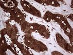 LGALS3 Antibody in Immunohistochemistry (Paraffin) (IHC (P))