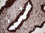 LGALS3 Antibody in Immunohistochemistry (Paraffin) (IHC (P))