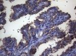 LGALS3 Antibody in Immunohistochemistry (Paraffin) (IHC (P))