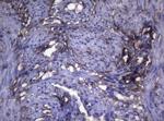 LGALS3 Antibody in Immunohistochemistry (Paraffin) (IHC (P))