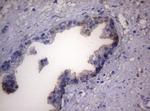 LGALS3 Antibody in Immunohistochemistry (Paraffin) (IHC (P))