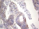 LGALS3 Antibody in Immunohistochemistry (Paraffin) (IHC (P))