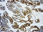 LGALS3 Antibody in Immunohistochemistry (Paraffin) (IHC (P))