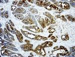LGALS3 Antibody in Immunohistochemistry (Paraffin) (IHC (P))