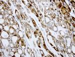 LGALS3 Antibody in Immunohistochemistry (Paraffin) (IHC (P))