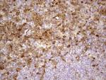 LGALS3 Antibody in Immunohistochemistry (Paraffin) (IHC (P))