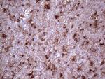 LGALS3 Antibody in Immunohistochemistry (Paraffin) (IHC (P))