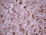 LGALS3 Antibody in Immunohistochemistry (Paraffin) (IHC (P))