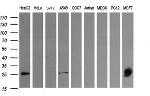 LGALS3 Antibody in Western Blot (WB)