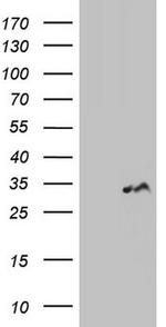 LGALS3 Antibody in Western Blot (WB)